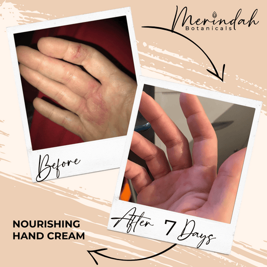 Images feature a hand with dry skin before and after using the product. The "Before" image displays red, dry skin, while the "After 7 Days" image shows noticeably smoother and healthier-looking skin. In the background, text highlights Merindah Botanicals' Nourishing Hand Cream, enhanced with Australian Finger Lime Caviar.